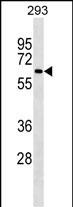 Mouse Monoclonal Antibody to NCOA4(Ascites)