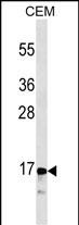 Mouse Monoclonal Antibody to CALCA/CT