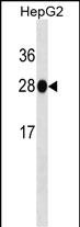 Mouse Monoclonal Antibody to HNMT(Ascites)