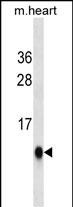 Mouse Monoclonal Antibody to UBL5(Ascites)