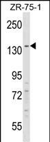 Rabbit Polyclonal Antibody to RFX1