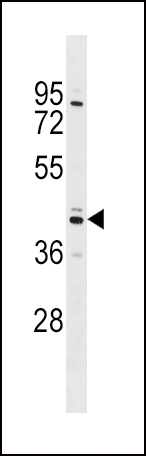 Rabbit Polyclonal Antibody to SHBG (N-term)