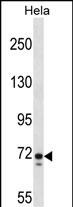 Rabbit Polyclonal Antibody to GALNT6