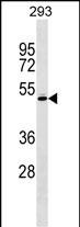 Rabbit Polyclonal Antibody to RCBTB1