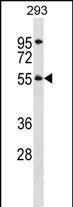 Rabbit Polyclonal Antibody to TTC8 (N-term)