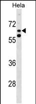 Rabbit Polyclonal Antibody to KLHL38 (N-term)