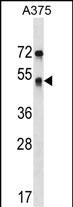 Rabbit Polyclonal Antibody to SEPT11
