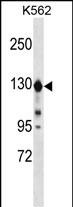 Rabbit Polyclonal Antibody to ESYT1