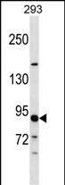 Rabbit Polyclonal Antibody to TUBGCP3