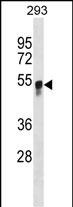 Rabbit Polyclonal Antibody to GCNT3 (N-term)