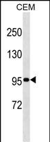 Rabbit Polyclonal Antibody to USP1