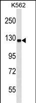 Rabbit Polyclonal Antibody to UBA6