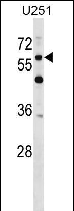 Rabbit Polyclonal Antibody to CSPG5