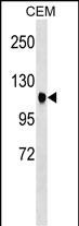 Rabbit Polyclonal Antibody to ATXN7