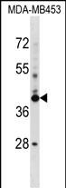 Rabbit Polyclonal Antibody to SRRD