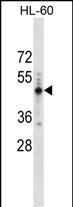 Rabbit Polyclonal Antibody to PRAMEF14