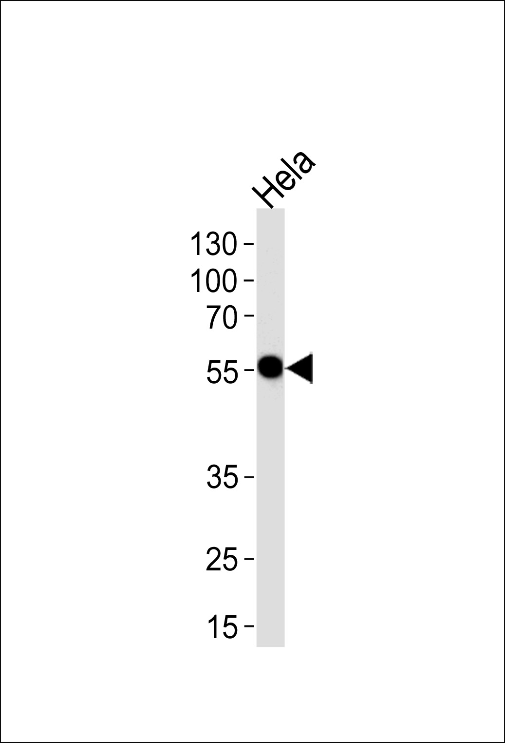 Rabbit Polyclonal Antibody to DDX6