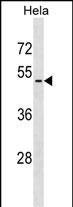 Rabbit Polyclonal Antibody to VIPR2 (N-term)