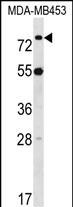 Rabbit Polyclonal Antibody to LDB3