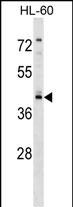 Rabbit Polyclonal Antibody to RGS11