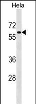 Rabbit Polyclonal Antibody to PAF1