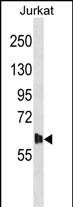 Rabbit Polyclonal Antibody to DMPK (N-term)