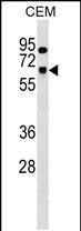 Rabbit Polyclonal Antibody to SNRNP70