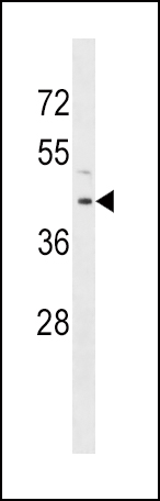 Rabbit Polyclonal Antibody to RRM2B