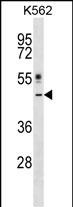 Rabbit Polyclonal Antibody to CRLF1
