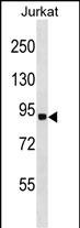 Rabbit Polyclonal Antibody to RNF10 (N-term)