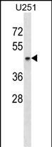 Rabbit Polyclonal Antibody to SH3GL1