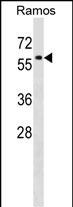 Rabbit Polyclonal Antibody to P4HA1