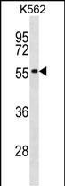 Rabbit Polyclonal Antibody to POLR1E
