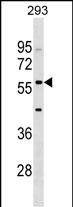 Rabbit Polyclonal Antibody to IFIT2