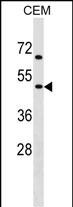 Rabbit Polyclonal Antibody to CHRNG (N-term)
