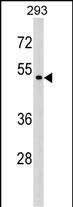 Rabbit Polyclonal Antibody to P2RX6