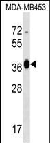 Rabbit Polyclonal Antibody to GFOD2 (N-term)
