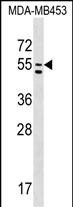 Rabbit Polyclonal Antibody to PTDSS1