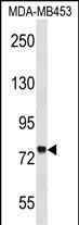 Rabbit Polyclonal Antibody to ZNF16 (N-term)