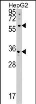 Rabbit Polyclonal Antibody to CDS2