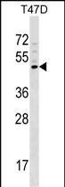 Rabbit Polyclonal Antibody to GCNT1