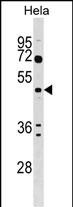 Rabbit Polyclonal Antibody to ALG2
