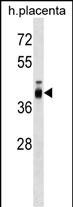 Rabbit Polyclonal Antibody to ZP3
