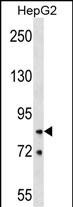 Rabbit Polyclonal Antibody to HNRNPR (N-term)