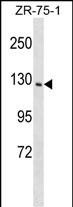 Rabbit Polyclonal Antibody to PITPNM1 (N-term)