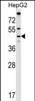 Rabbit Polyclonal Antibody to MCAT