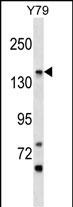 Rabbit Polyclonal Antibody to PIGO