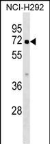Rabbit Polyclonal Antibody to ZBTB44
