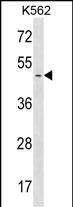 Rabbit Polyclonal Antibody to PPME1