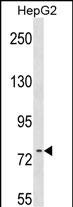 Rabbit Polyclonal Antibody to RRN3